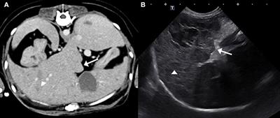 Successful Long-Term Management of Canine Superficial Necrolytic Dermatitis With Amino Acid Infusions and Nutritionally Balanced Home-Made Diet Modification